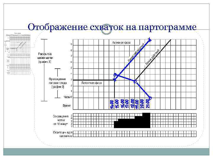 Партограмма в акушерстве как заполнять образец заполнения