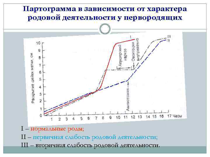Партограмма в зависимости от характера родовой деятельности у первородящих I – нормальные роды; II