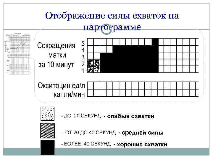 Отображение силы схваток на партограмме - слабые схватки - средней силы - хорошие схватки