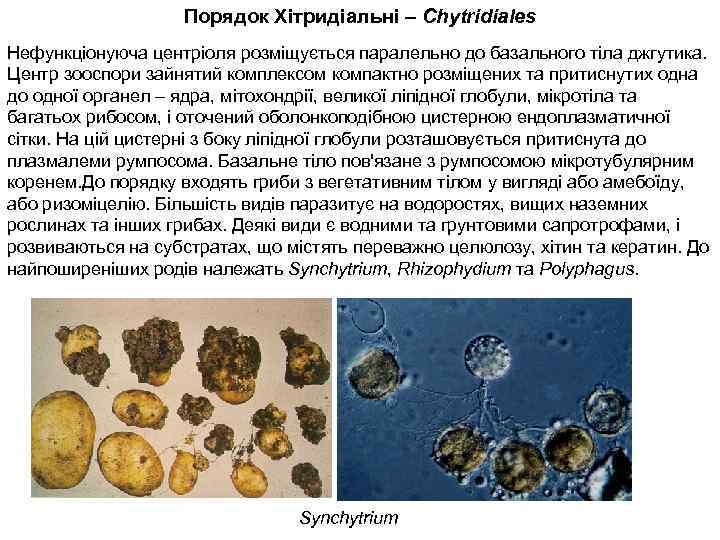 Порядок Хітридіальні – Chytridiales Нефункціонуюча центріоля розміщується паралельно до базального тіла джгутика. Центр зооспори