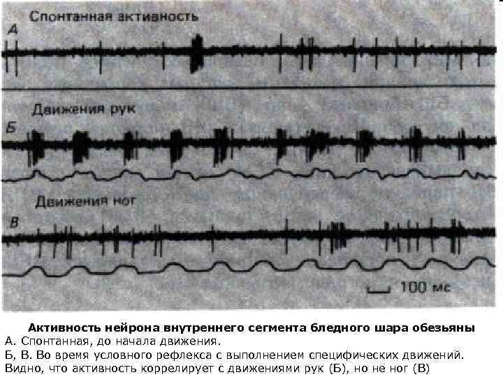 Активность нейрона внутреннего сегмента бледного шара обезьяны А. Спонтанная, до начала движения. Б, В.
