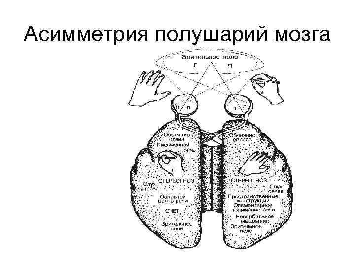 Асимметрия полушарий мозга 