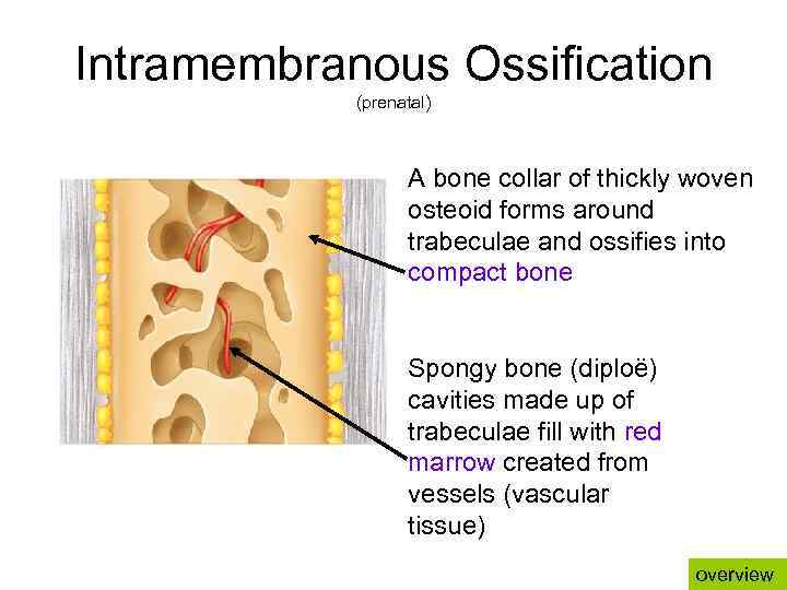 Intramembranous Ossification (prenatal) A bone collar of thickly woven osteoid forms around trabeculae and