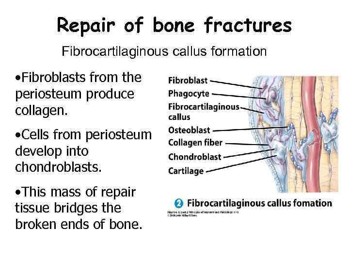 Repair of bone fractures Fibrocartilaginous callus formation • Fibroblasts from the periosteum produce collagen.