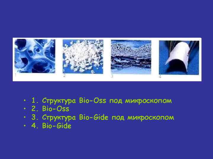  • • 1. 2. 3. 4. Структура Bio-Oss под микроскопом Bio-Oss Структура Bio-Gide