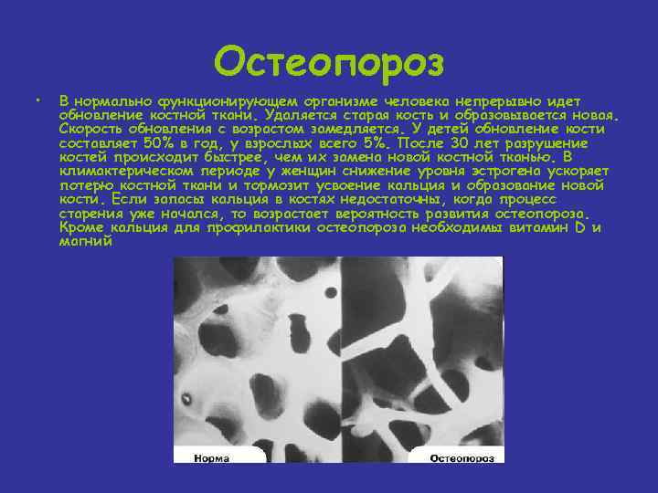 Остеопороз • В нормально функционирующем организме человека непрерывно идет обновление костной ткани. Удаляется старая