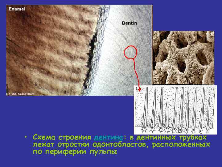 Дентинные канальцы зуба фото