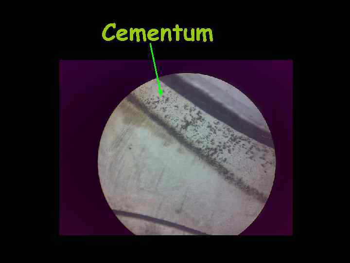 Cementum 