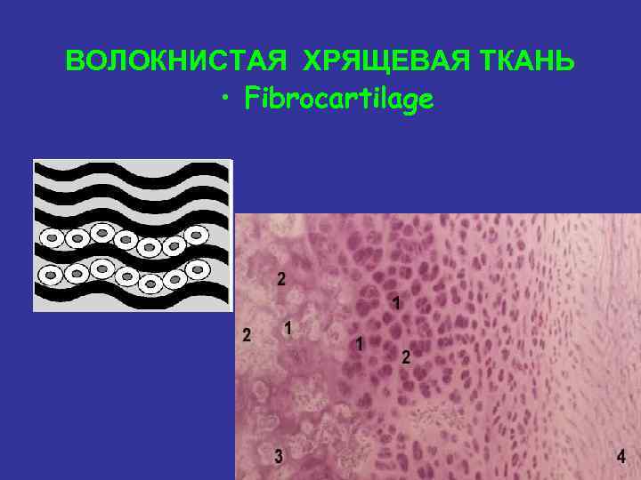 ВОЛОКНИСТАЯ ХРЯЩЕВАЯ ТКАНЬ • Fibrocartilage 