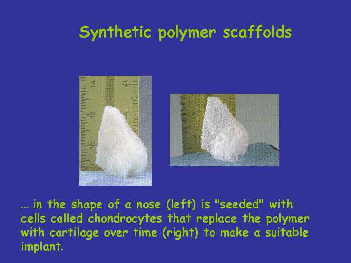 Synthetic polymer scaffolds . . . in the shape of a nose (left) is