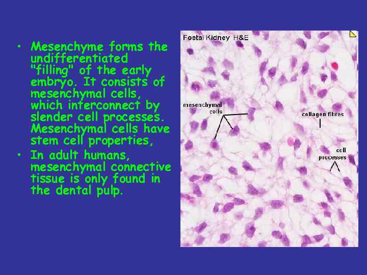  • Mesenchyme forms the undifferentiated 