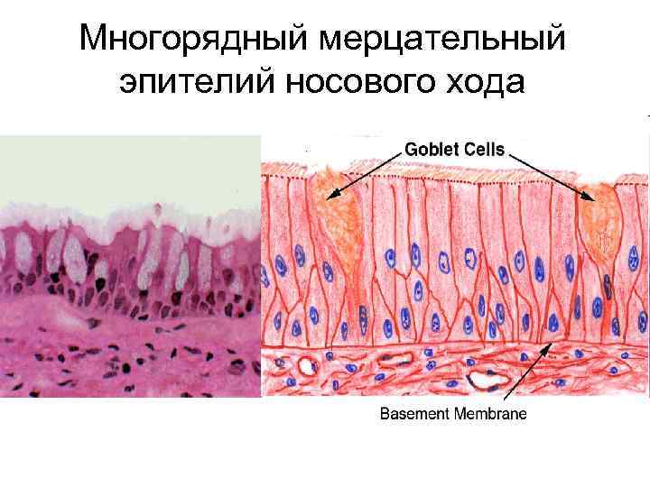 Многорядный мерцательный эпителий носового хода 