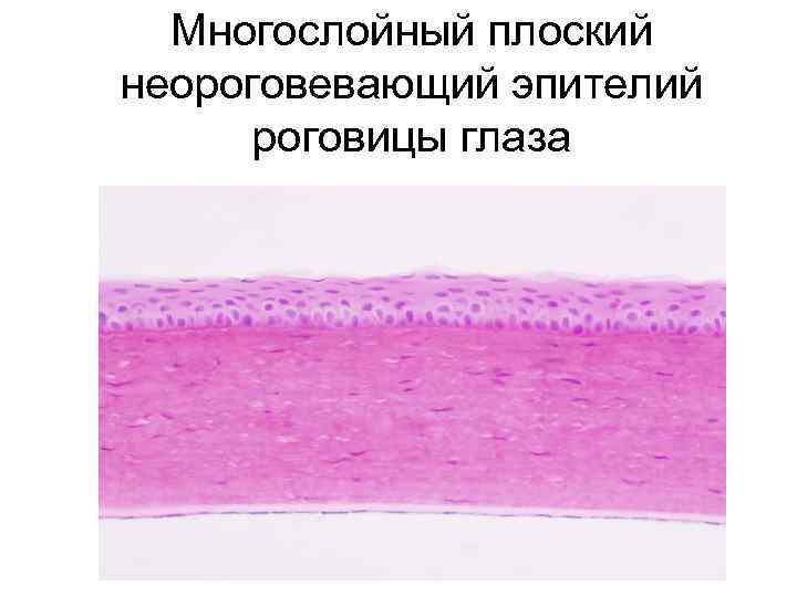 Многослойный плоский неороговевающий эпителий роговицы глаза 