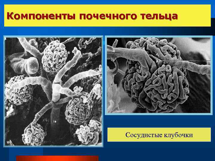 Компоненты почечного тельца Сосудистые клубочки 