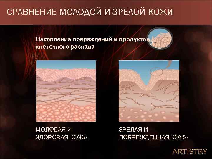 СРАВНЕНИЕ МОЛОДОЙ И ЗРЕЛОЙ КОЖИ Накопление повреждений и продуктов клеточного распада МОЛОДАЯ И ЗДОРОВАЯ