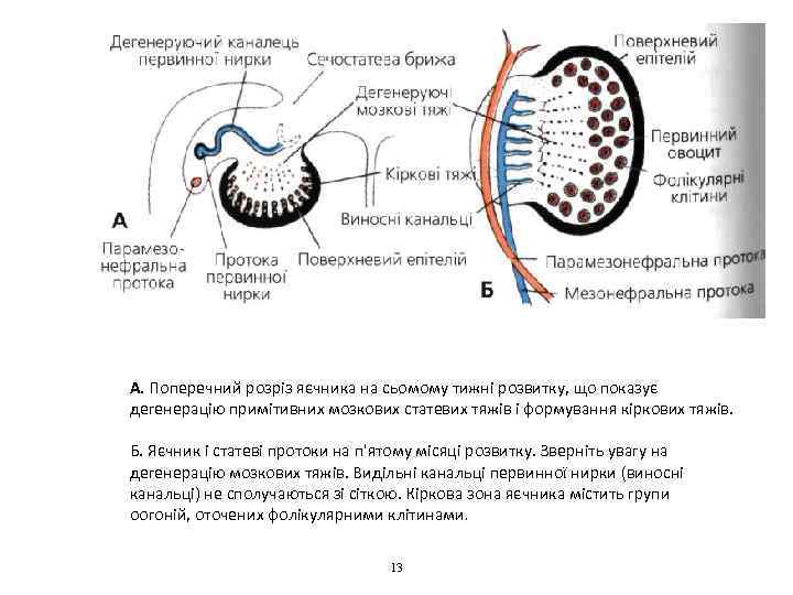 А. Поперечний розріз яєчника на сьомому тижні розвитку, що показує дегенерацію примітивних мозкових статевих