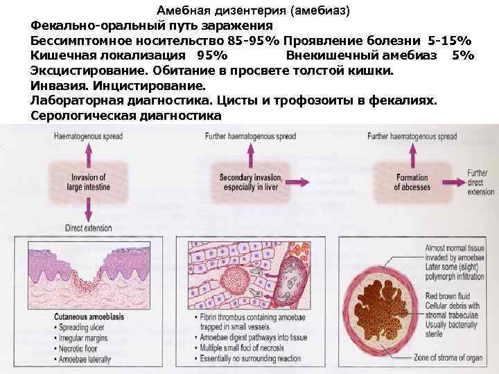 Заболевания вызванные амебами. Амебиаз этиология эпидемиология. Амебиаз кишечника микропрепарат. Амебиаз биология симптомы.