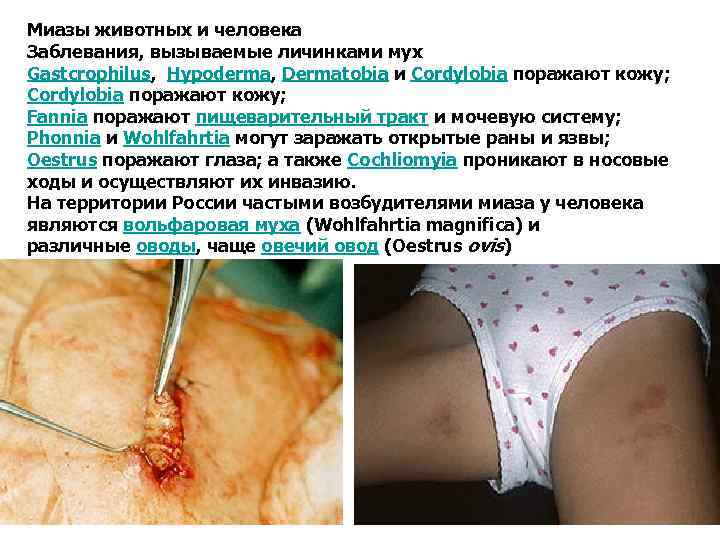 Миазы животных и человека Заблевания, вызываемые личинками мух Gastcrophilus, Hypoderma, Dermatobia и Cordylobia поражают