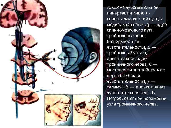 А. Схема чувствительной иннервации лица: 1 - спиноталамический путь; 2 — медиальная петля; 3