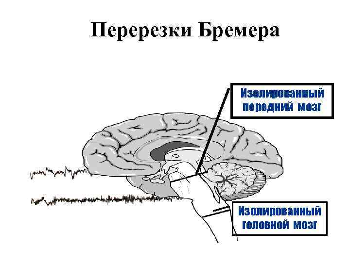 Перерезки Бремера Изолированный передний мозг Изолированный головной мозг 