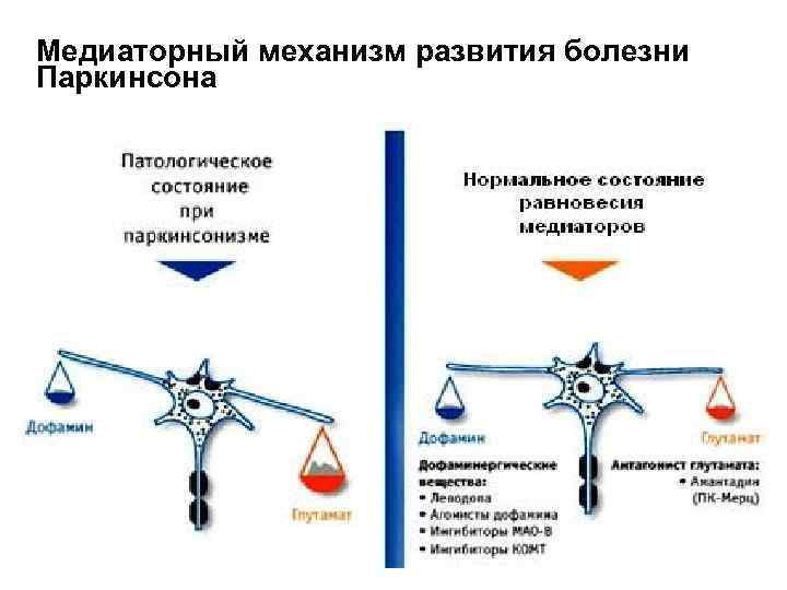 Медиаторный механизм развития болезни Паркинсона 