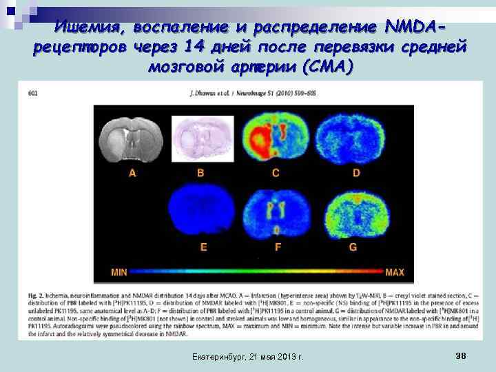 Ишемия, воспаление и распределение NMDAрецепторов через 14 дней после перевязки средней мозговой артерии (СМА)