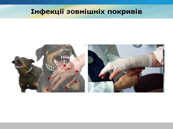 Інфекції зовнішніх покривів 