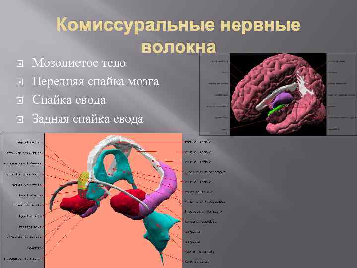 Характеристика слова спайка. Передняя спайка мозолистого тела. Мозолистое тело свод передняя спайка анатомия. Передняя и задняя спайка мозга. Мозолистое тело свод и спайки.