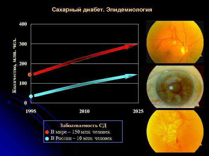 Сахарный диабет. Эпидемиология Количество, млн. чел. 400 300 200 100 0 1995 2010 Заболеваемость