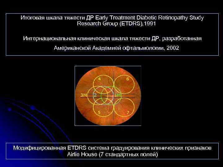 Итоговая шкала тяжести ДР Early Treatment Diabetic Retinopathy Study Research Group (ETDRS), 1991 Интернациональная