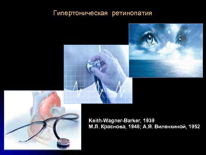 Гипертоническая ретинопатия Keith-Wagner-Barker, 1939 М. Л. Краснова, 1948; А. Я. Виленкиной, 1952 