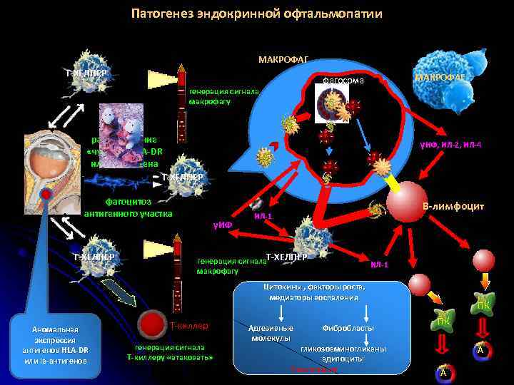 Патогенез эндокринной офтальмопатии МАКРОФАГ Т-ХЕЛПЕР МАКРОФАГ фагосома генерация сигнала макрофагу распознавание «чужого» HLA-DR или