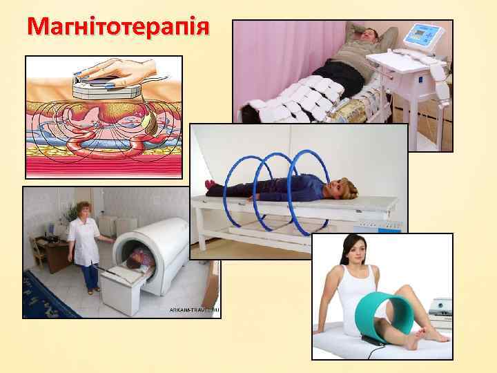 Магнітотерапія 