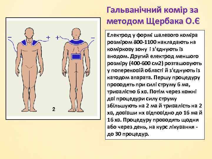 Гальванічний комір за методом Щербака О. Є Електрод у формі шалевого коміра розміром 800