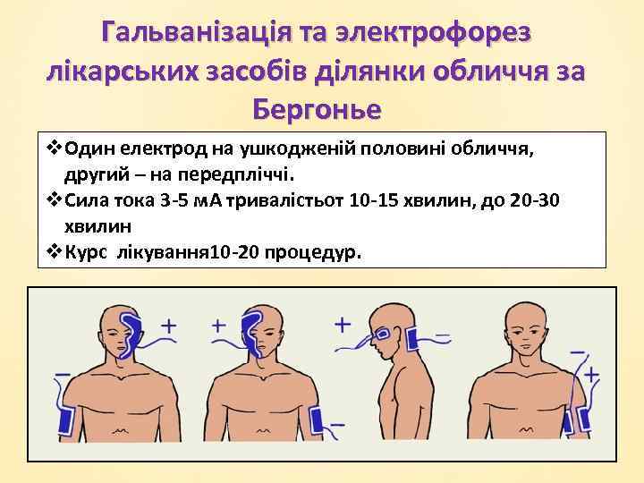 Гальванізація та электрофорез лікарських засобів ділянки обличчя за Бергонье v. Один електрод на ушкодженій
