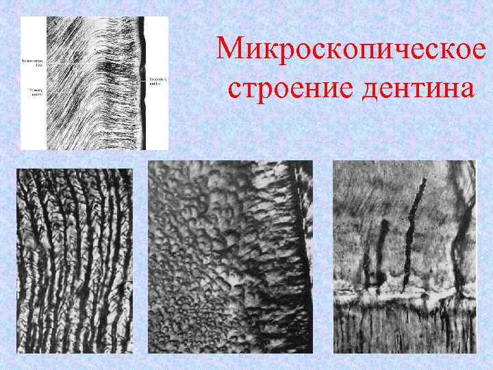 Микроскопическое строение дентина 