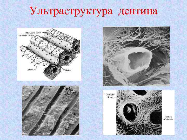 Ультраструктура дентина 