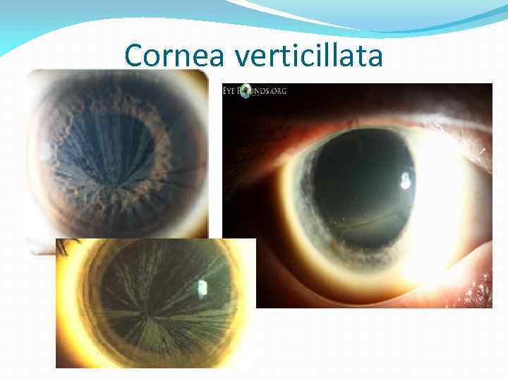 Cornea verticillata 