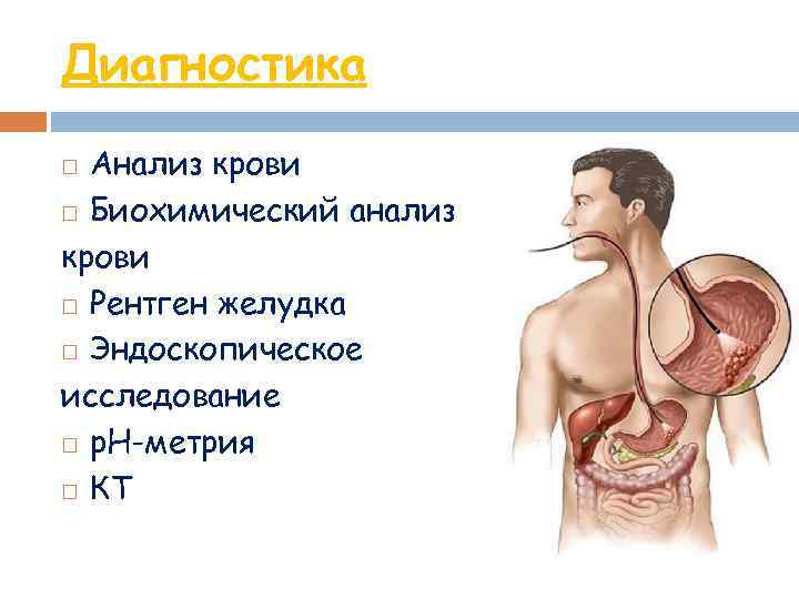 Диагностика Анализ крови Биохимический анализ крови Рентген желудка Эндоскопическое исследование р. Н-метрия КТ 