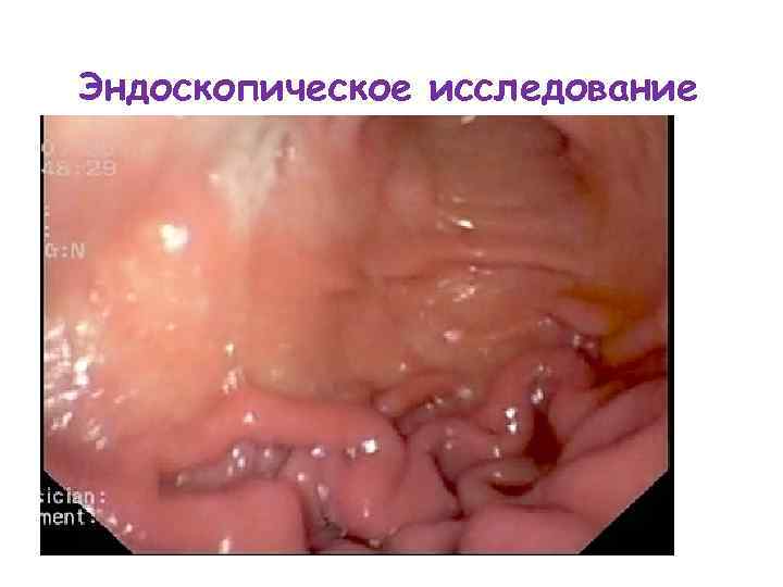 Эндоскопическое исследование 