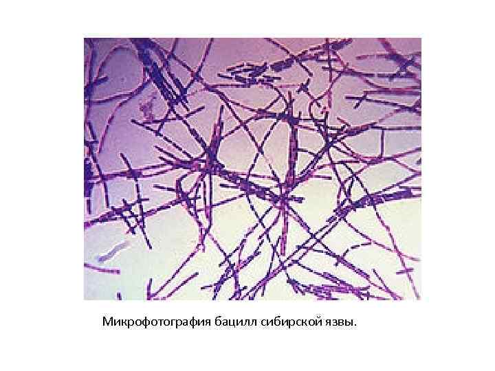Бациллы сибирской язвы презентация