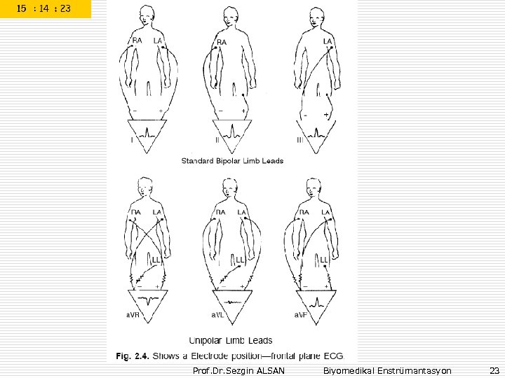 Prof. Dr. Sezgin ALSAN Biyomedikal Enstrümantasyon 23 