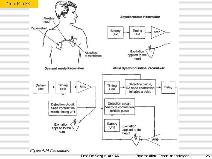 Prof. Dr. Sezgin ALSAN Biyomedikal Enstrümantasyon 26 