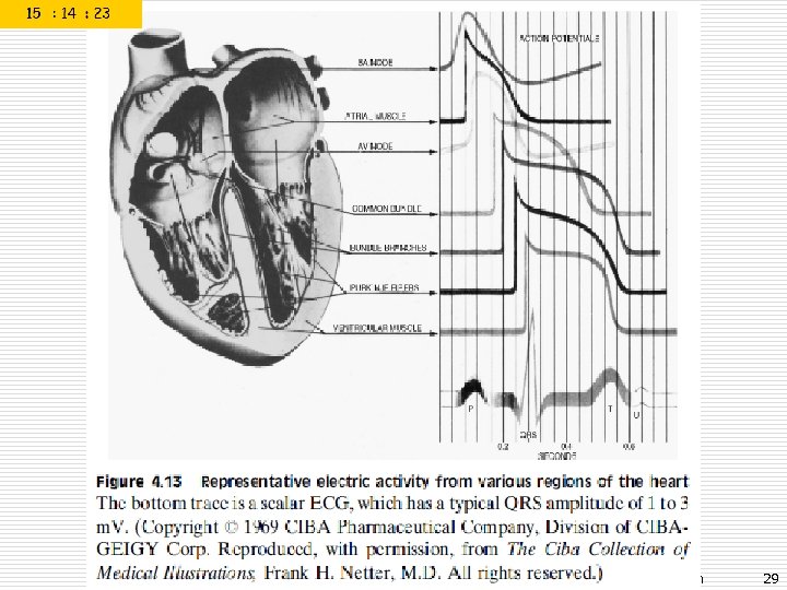 Prof. Dr. Sezgin ALSAN Biyomedikal Enstrümantasyon 29 