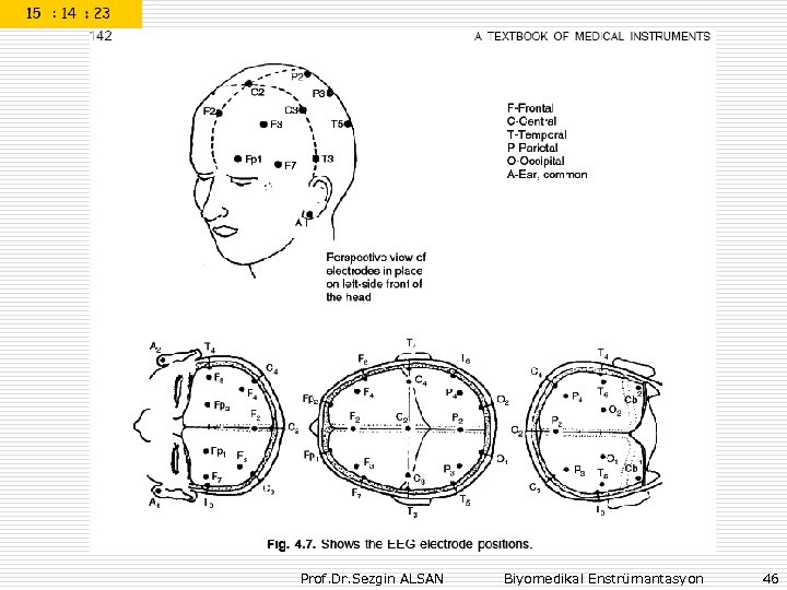Prof. Dr. Sezgin ALSAN Biyomedikal Enstrümantasyon 46 