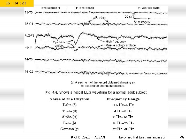 Prof. Dr. Sezgin ALSAN Biyomedikal Enstrümantasyon 48 