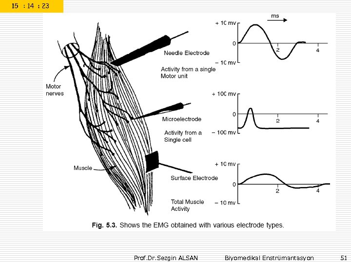 Prof. Dr. Sezgin ALSAN Biyomedikal Enstrümantasyon 51 