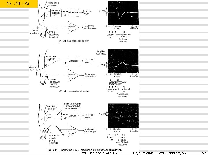 Prof. Dr. Sezgin ALSAN Biyomedikal Enstrümantasyon 52 