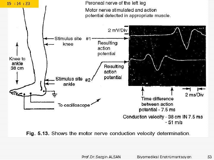Prof. Dr. Sezgin ALSAN Biyomedikal Enstrümantasyon 53 