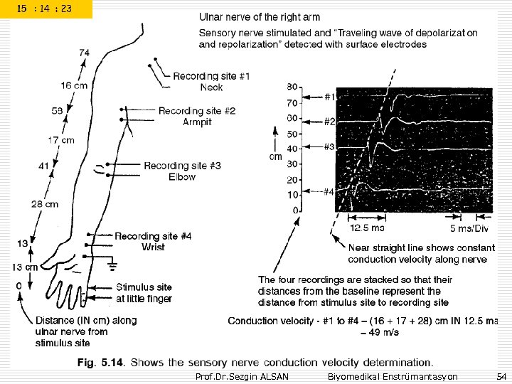 Prof. Dr. Sezgin ALSAN Biyomedikal Enstrümantasyon 54 